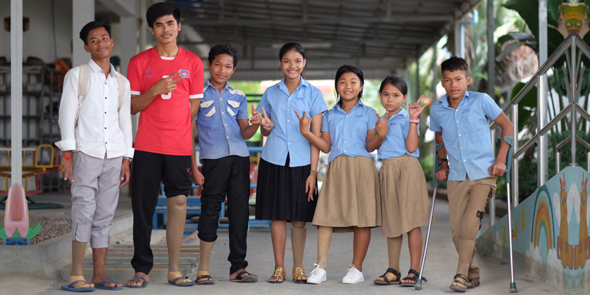 Charity Event to Raise $ for Prosthetic Pediatric Limbs