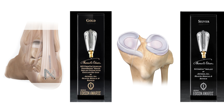 Arthrex Innovations: Finalists for 2024 Edison Awards