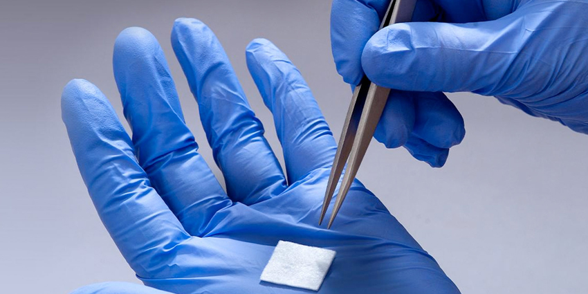 Promising Novel Cartilage Implant Data Presented