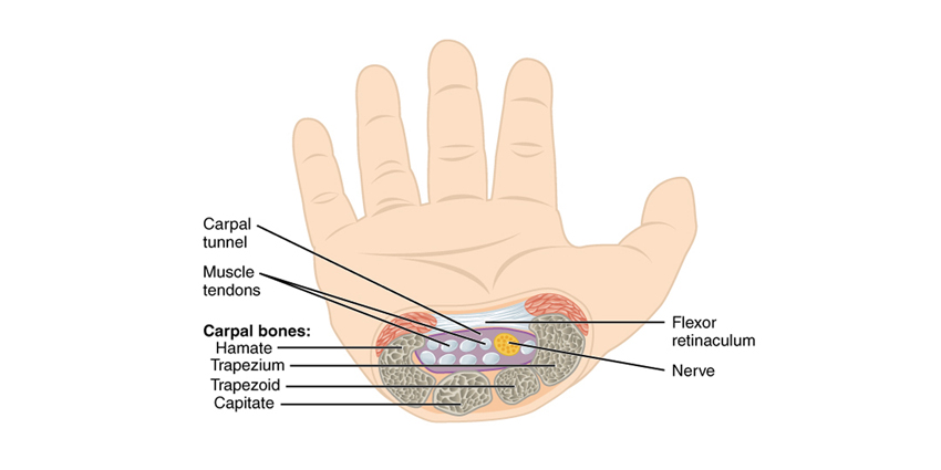 Updated Carpal Tunnel Practice Guidelines From AAOS