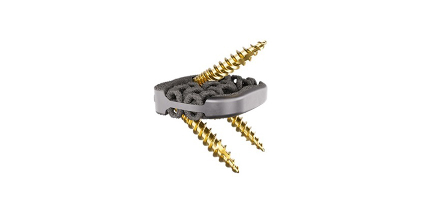 FDA Clears Camber Spine’s New Anterior Integrated System