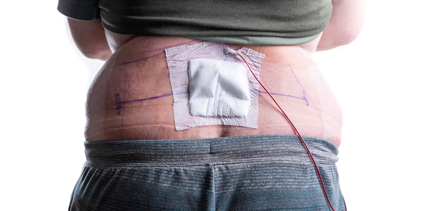 New Study Predicts Post-Op Spine Complications