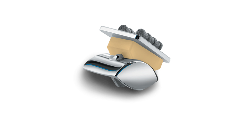 Vitamin E Blended Ankle Replacement Launched