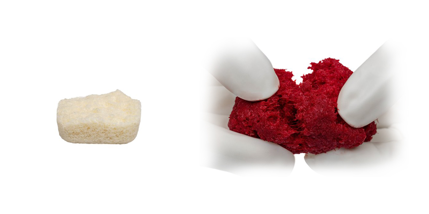 LifeNet, J&J MedTech Introduce New Bone Allograft