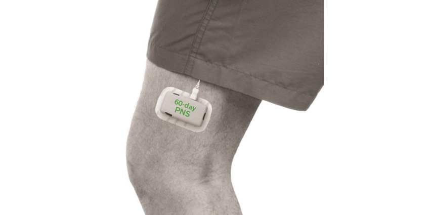 New Study: Nerve Stim Lowers Post Op TKA Pain ≥50%