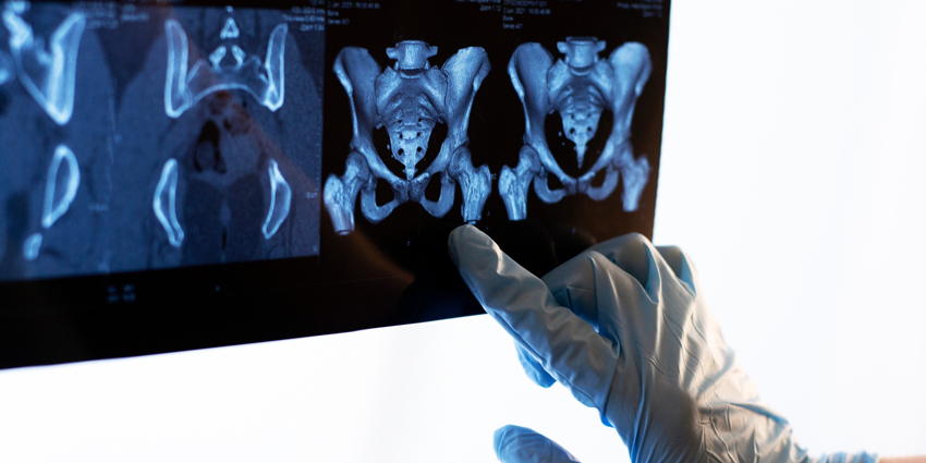 ASPN Issues SI Joint Pain Treatment Guidelines