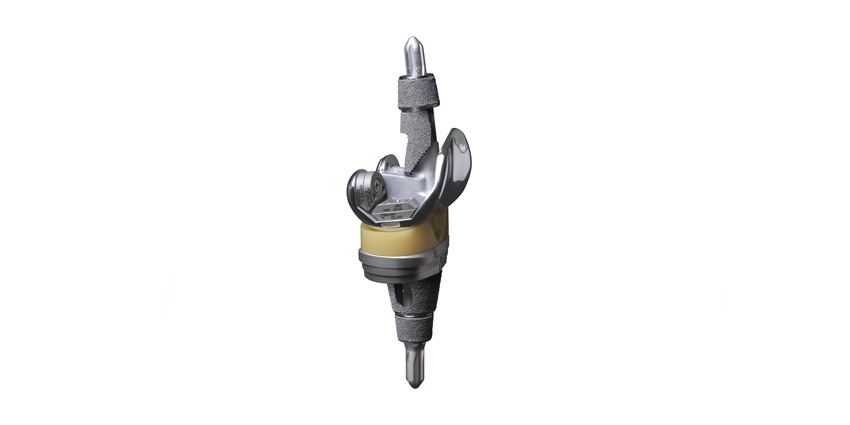 Enovis Launches Expanded Knee Revision System
