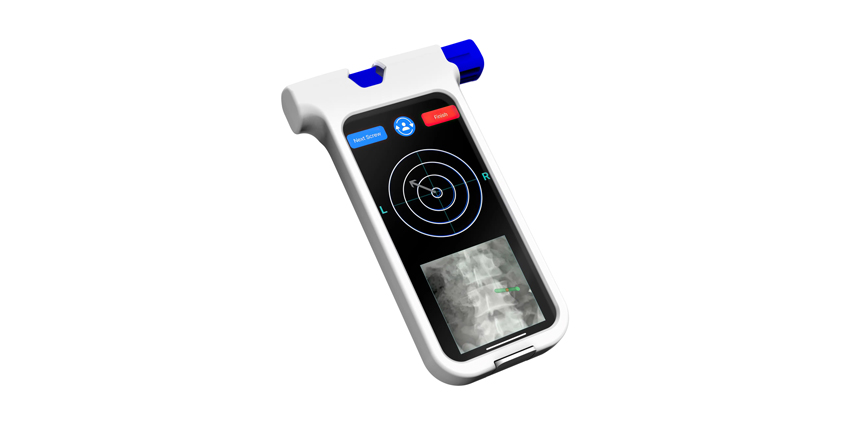 Handheld Spine Navigation Charges Ahead With Bolt 2.0