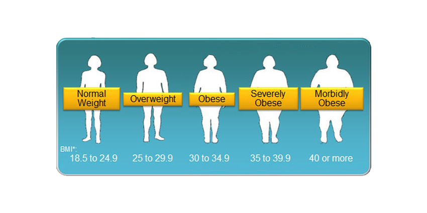 High BMI Increases Joint Arthroplasty Costs 2-8%