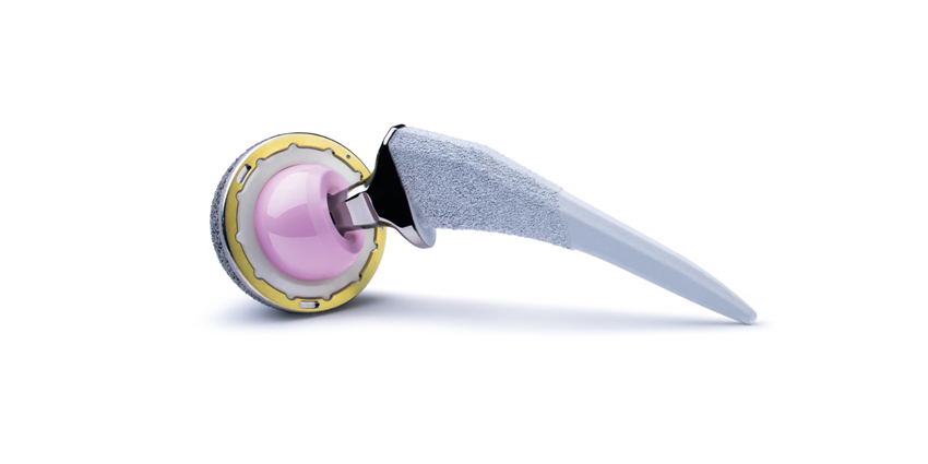 More Versatile, Comprehensive Femoral Hip System Launched