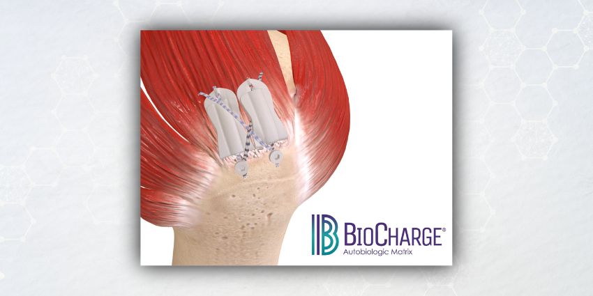 Novel Autobiologic Rotator Cuff Matrix Cleared