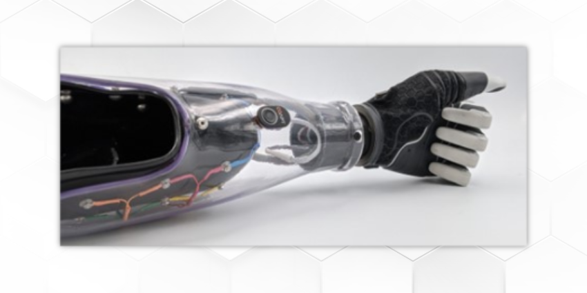 Hanger Bets BIG on Intuitive Prosthetics