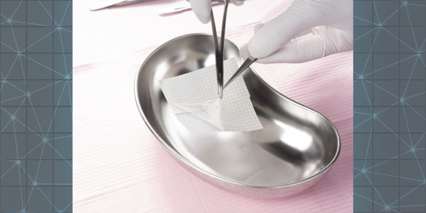 Birth Tissues Put to a High Energy Trauma Test