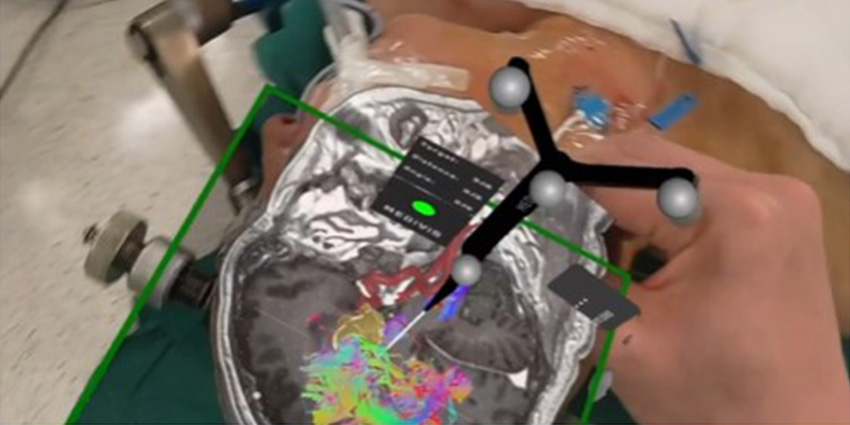 Augmented Reality Spine Navigation For the ASC
