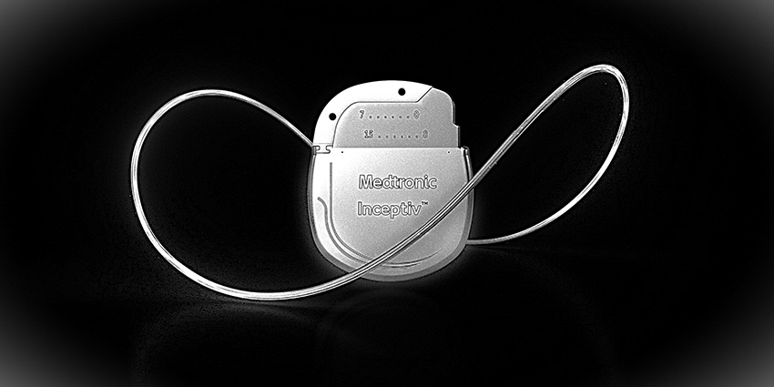 How Durable Are Spinal Cord Stim Outcomes?