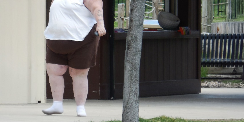 The Current and Future Direction of Obesity Treatment