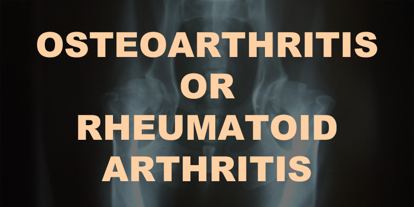 RA or OA? No Difference in Anterior Hip Outcomes