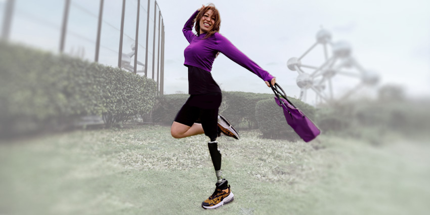 The Power of Osseointegration for Above-Knee Amputees