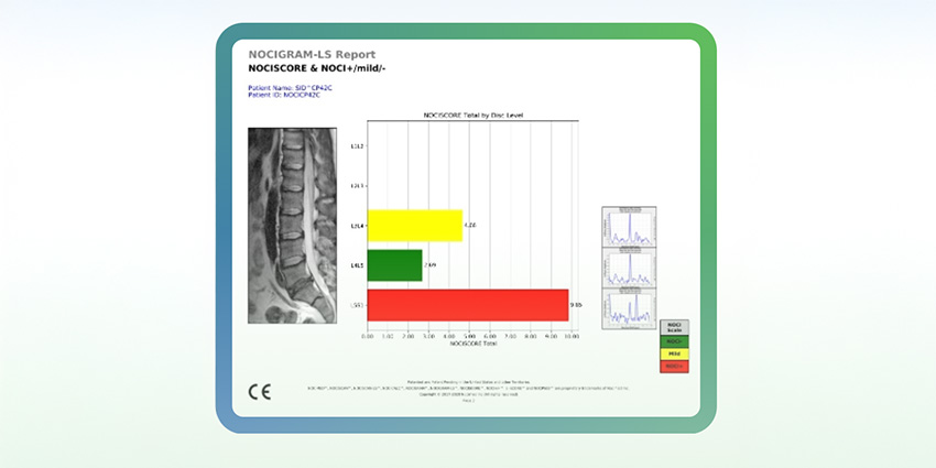 Virtual Discogram Outperforms in New Outcome Study
