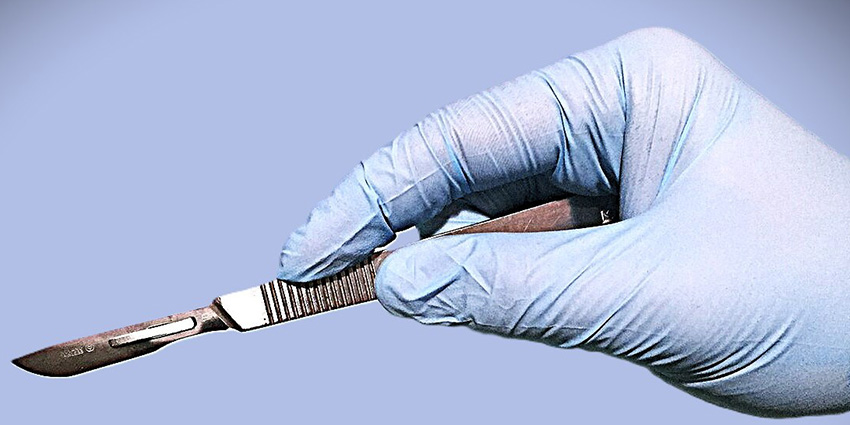 Hamstring Avulsions: Scalpel Wins the Race Back to the Field