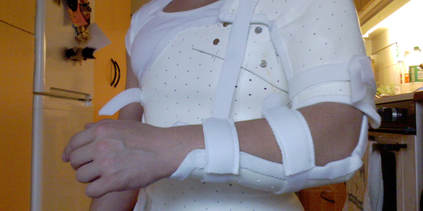 14 Reps to Cracking the Code on Lower Trapezius Tendon Transfer?