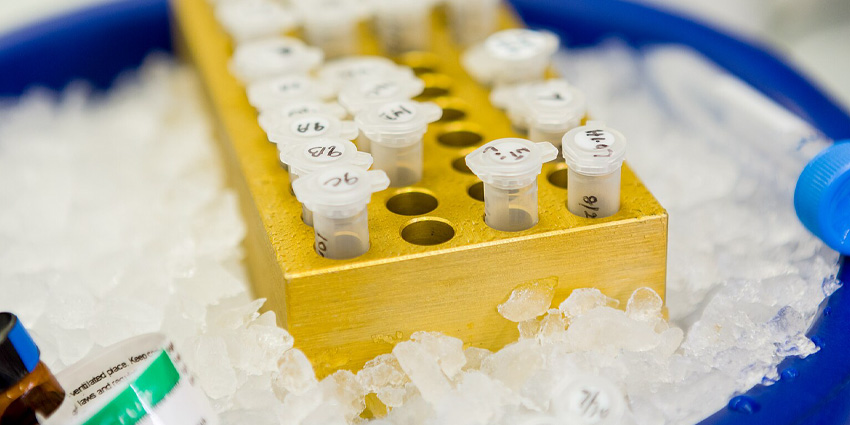 Tiny Bubbles, Big Breakthrough: Diagnosing Ankylosing Spondylitis