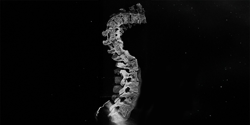 Double the Tethers, Double the Trouble? NYU Team Digs In