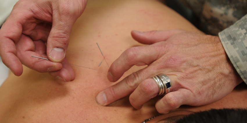 Zapping the Brain Fog: Acupuncture for Hip Fracture Patients?