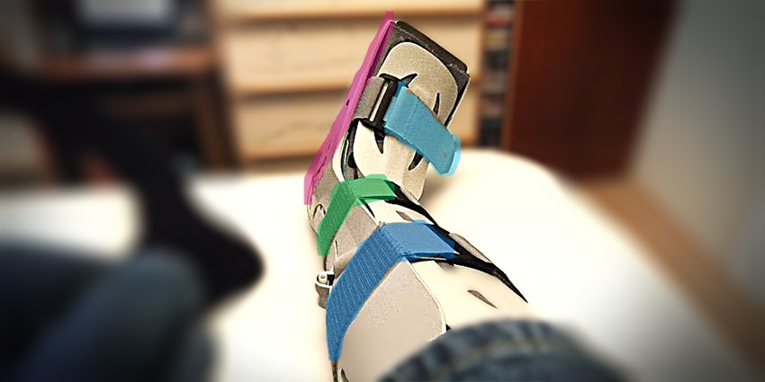 Walking Wins After Ankle Fracture Surgery