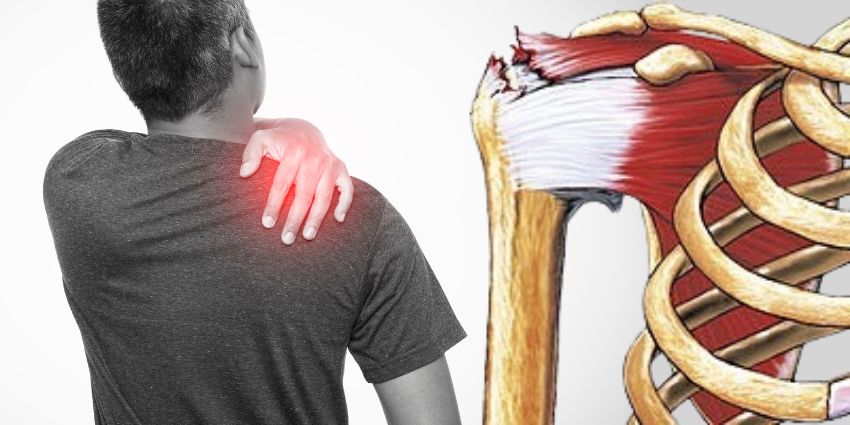 Rotator Cuff Repair Costs: It’s the Implants, Stupid