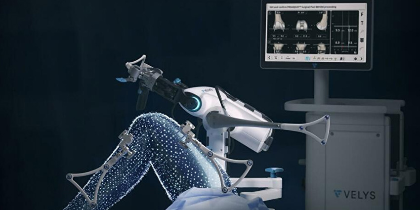 VELYS Robotic TKA: A Short Ramp, Not a Mountain