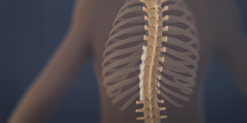 Dynamic Scoliosis Tethering: Next Generation Tech Review