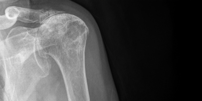 BMS: Better Healing Doesn’t Mean Better Scores