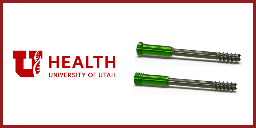University of Utah Orthopaedic Innovation Center Unveils Breakthrough Dynamic Compression Implant System