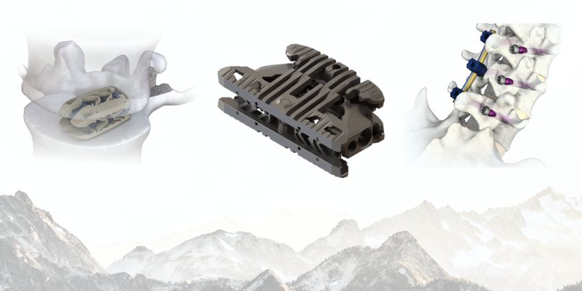 Highridge Medical Steps Into the Expandable Cage Wars