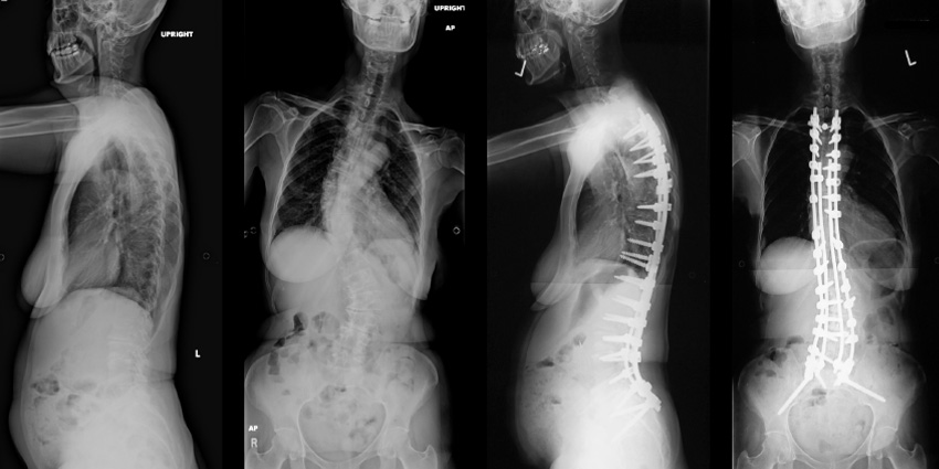 Two Years, Seven Screws and What Happens Next?