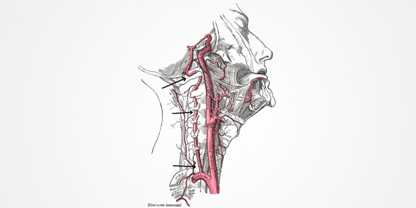 Vertebral Artery Injury: “Sleeper Diagnosis” Packs a Punch
