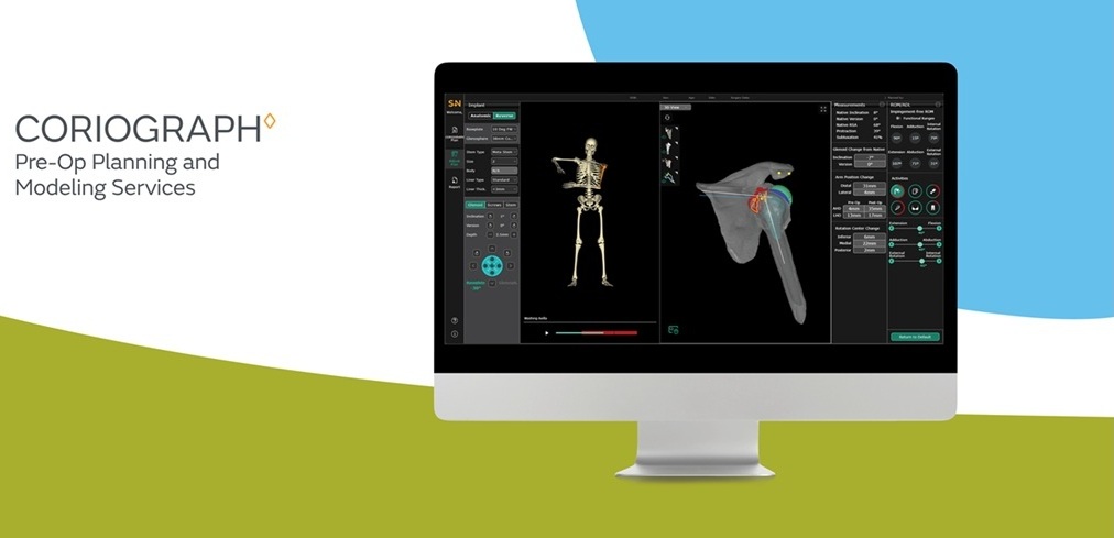 Smith+Nephew launches CORIOGRAPH™ Pre-Op Planning and Modeling Services for total shoulder arthroplasty