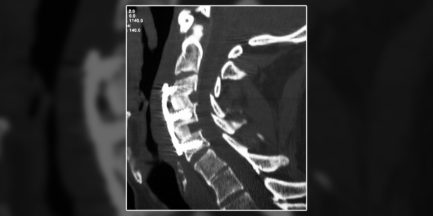 A Radiographic Rollercoaster Through RCTs