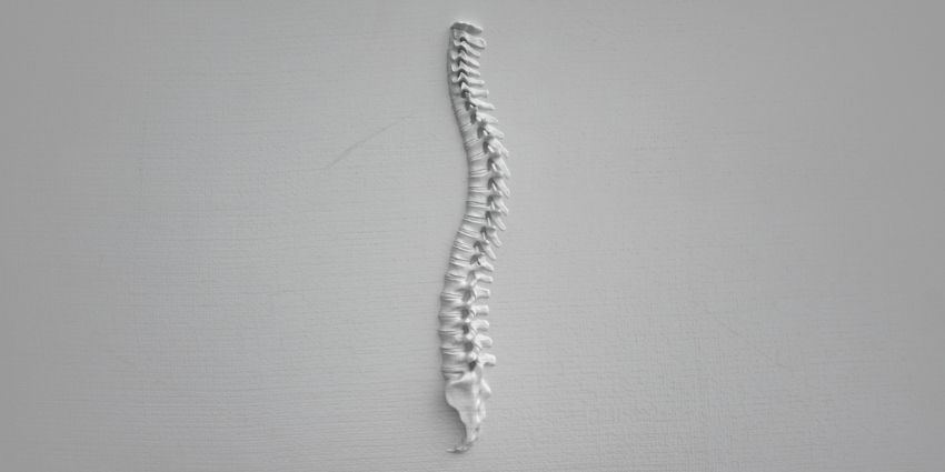 The Mystery Meat: What Paraspinal Sarcopenia Tells Us About DLSS