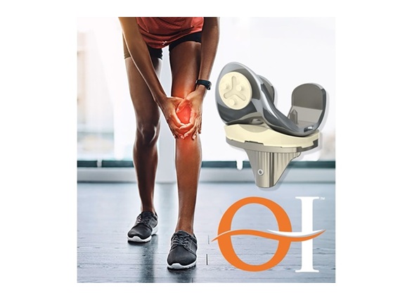 A Game Changer for Active Individuals, Knee Replacement Patients in Texas, Enjoy Faster Recoveries thanks to Optimotion Implants