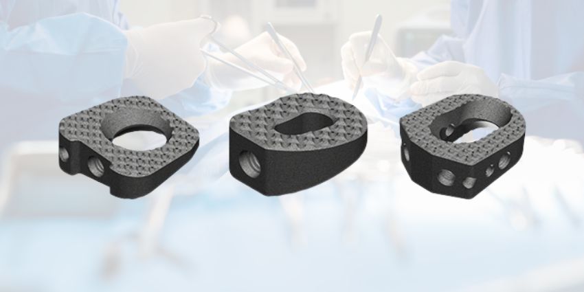FDA Greenlights a New Material for Foot and Ankle Reconstruction