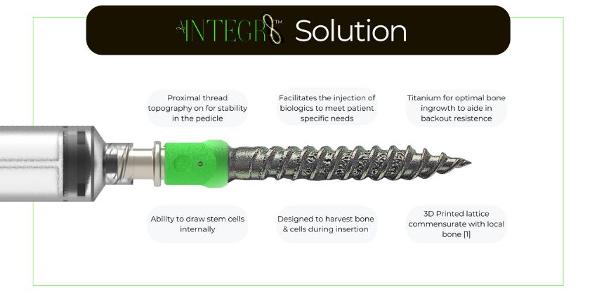 1st Cleared Porous Pedicle Screw System Is “Therapeutic Hardware”