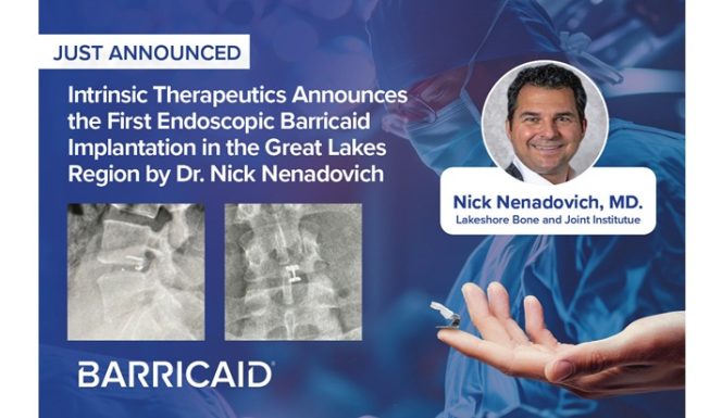Intrinsic Therapeutics Announces the First Endoscopic Barricaid Implantation in the Great Lakes Region by Dr. Nick Nenadovich