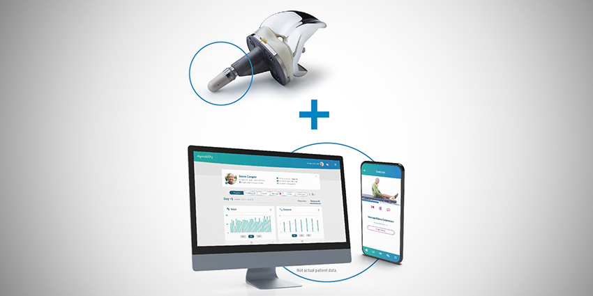 A Knee That Talks Back: Rochester Regional Health Implants “Smart Knee”