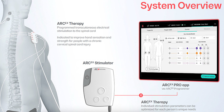 FDA Greenlights Home Stim for Spinal Cord Injury