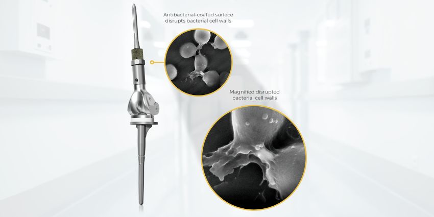FDA Clears Novel Antibacterial Tech for Limb Salvage System