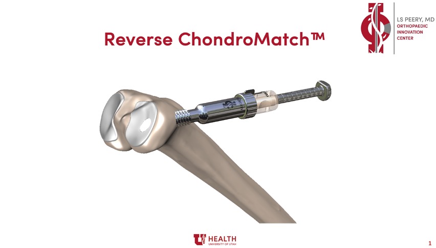 University Of Utah Orthopaedic Innovation Center Announces Completion of First ChondroMatch™ Case
