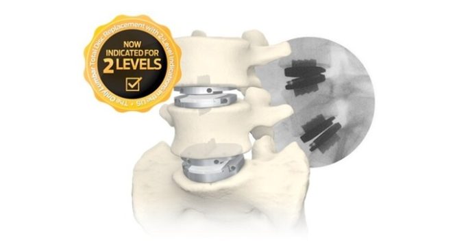Coverage Expansion Continues for One- and Two-Level Lumbar Total Disc Replacement as One of the Leading Commercial Payers in Arizona Establishes Positive Coverage Criteria for Centinel Spine’s prodisc® L
