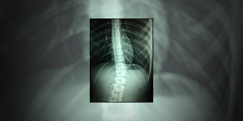 Growing Pains, Pelvic Clues, and the Quest for Skeletal Truth